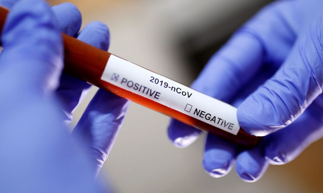 coronavirus covid-19 Serra