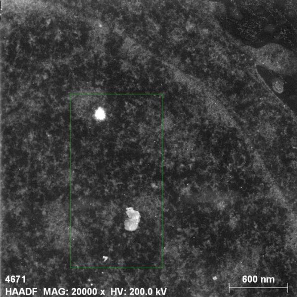 nanoparticulas